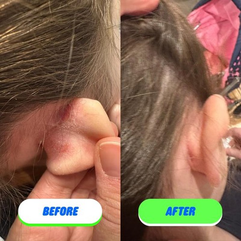 Pipa Skin Saver Hypochlorous Acid Spray for Face & Body 60 ml | Head to Toe Daily First Aid Skin Repair Spray for Sensitive Skin | Helps Reduce Eczema, Irritations, Rashes, Acne, Redness & Breakouts