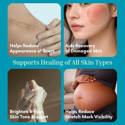The Vibrant Glow, Luxury Beautifying Oil for Scars & Stretch Marks, Brightening & Smoothening, Hydrating Face & Body, Pure Oil Blend with Vitamin E, Rosehip & Argan, Vegan, Dermatologist Tested, 2 oz