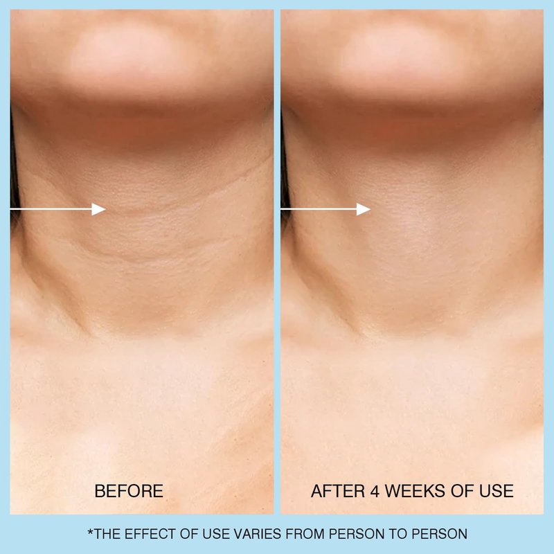 UJhay Retinol Neck Cream, Hyaluronic Acid and Caffeine Enriched Neck Firming Cream to Minimize Fine Lines & Dullness - 3-in-1 Moisturizing Cream for Neck, Chest and Face (50 ml/1.7 oz)