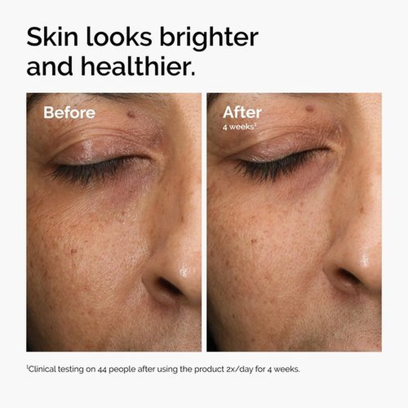 The Ordinary Vitamin C Serum - Multi-Antioxidant Radiance Booster for Glowing Skin | 1 Fl Oz