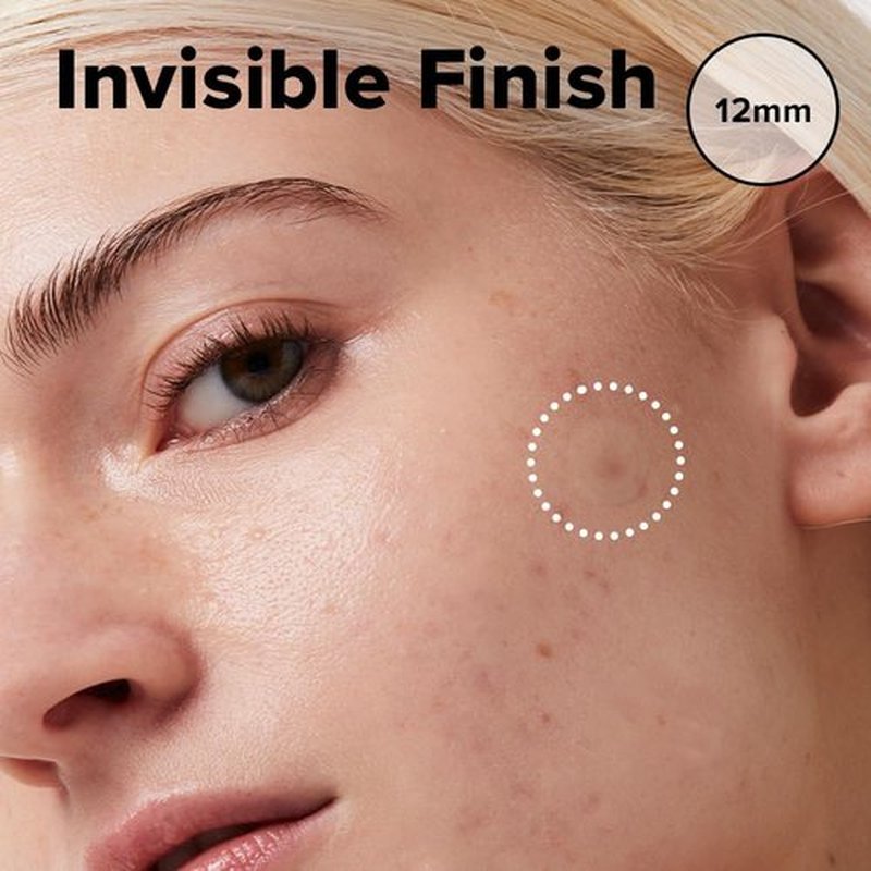 I DEW CARE Hydrocolloid Acne Pimple Patch - Timeout Blemish Plus | Korean zit Dark Spot Patches for face and skin, Pus absorbing with Tea Tree Leaf Oil, Facial Stickers, Large, 36 Count