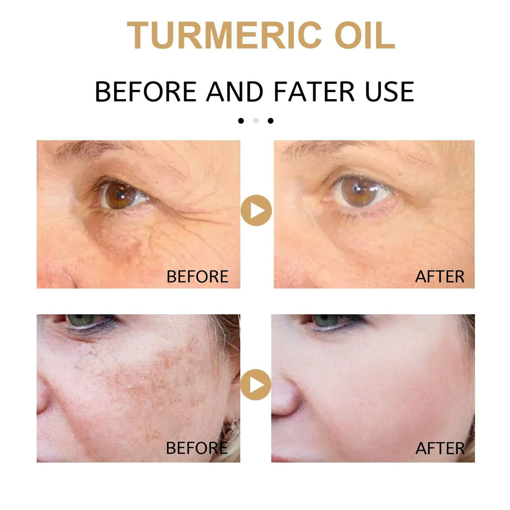 2 Pack Turmeric Dark Spot Corrector Serum, Natural Turmeric Dark Spot Corrector Serum for Face, Skin Care Moisturizing Repair (30mL/1.01 f.oz)