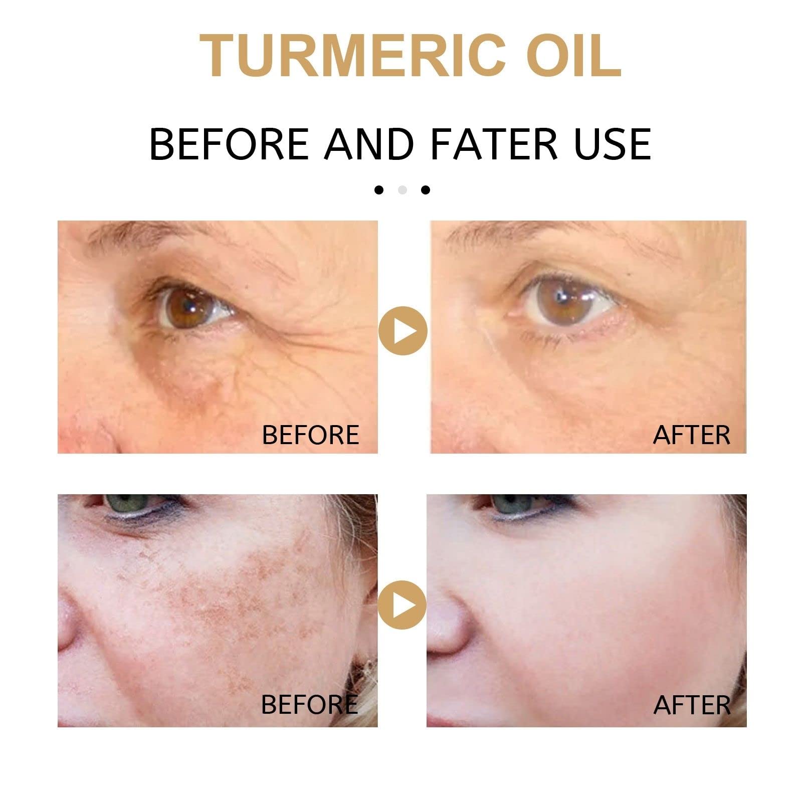 2 Pack Turmeric Dark Spot Corrector Serum, Natural Turmeric Dark Spot Corrector Serum for Face, Skin Care Moisturizing Repair (30mL/1.01 f.oz)