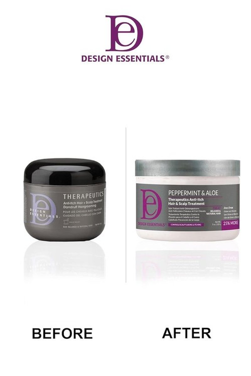 Design Essentials Peppermint & Aloe Anti-Itch Hair Treatment | Dandruff Relief, 5 Fl Oz, White