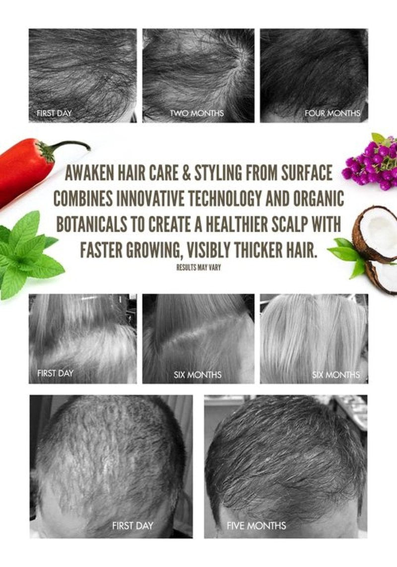 Surface Hair Awaken Kit - Shampoo, Conditioner & Scalp Elixir for Thinning Hair & Hair Loss