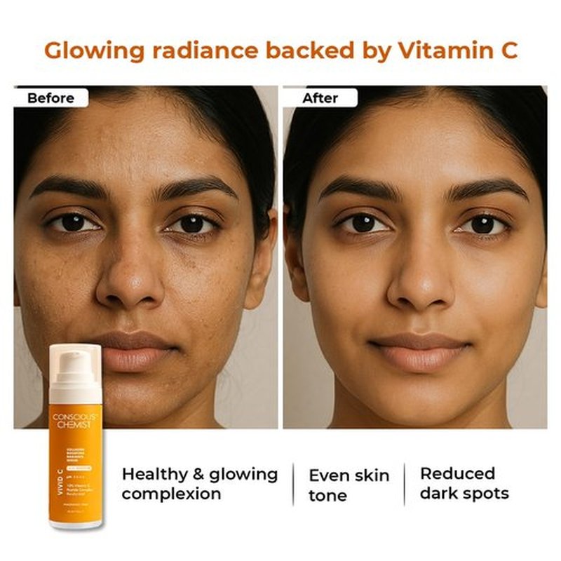 Conscious Chemist Vitamin C 10% Face Serum - Brightening & Anti-Aging | 30ml | Reduces Dark Circles & Fine Lines