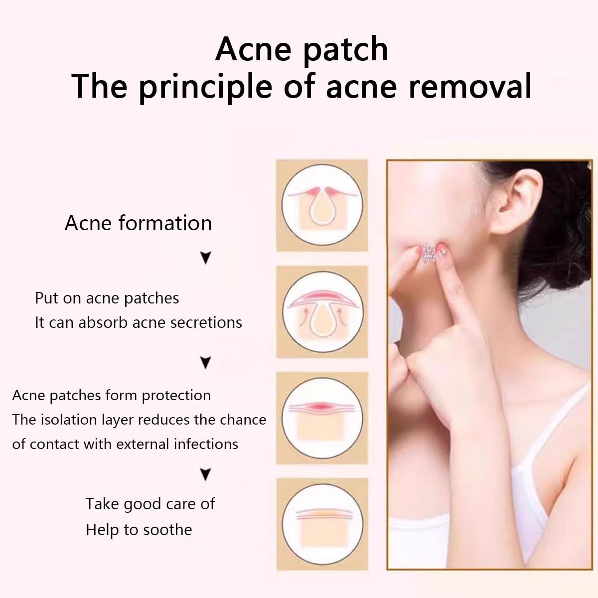 VibeSeal pimple patches 240pc Hydrocolloid Acne Spot Treatment Patch for Early Stage Zits and Hidden Pimples