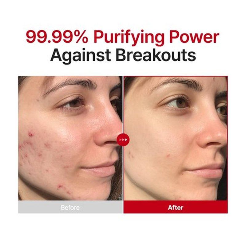 PURITO Hypochlorous Acid Facial Spray | Witch Hazel 5% + Forest Breeze | HOCl Facial Mist for Sensitive, Redness-Prone Skin | Refreshing Toner Mist | Korean Skincare, 100mL / 3.38 fl.oz