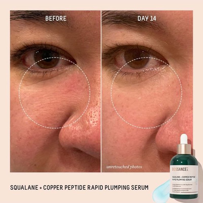 Biossance Squalane + Copper Peptide Serum - Rapid Plumping Face Serum for All Skin Types | Vegan Formula with Hyaluronic Acid