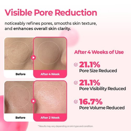 Dr.Melaxin Pink Spicule Cyano Microneedling Serum – Vitamin B12 Pore Minimizer, Liquid Microneedle Facial Treatment for Enlarged Pores, Skin Renewal & Texture Refining (30ml)