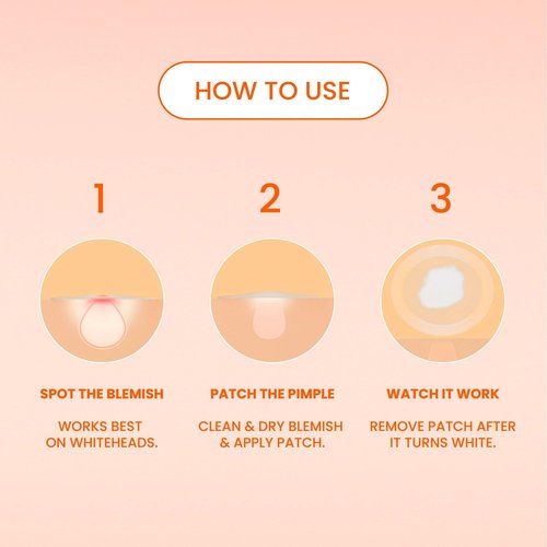 Biore Pimple Patches, Cover & Conquer Blemish Patch, Medical Grade Ultra-Thin Hydrocolloid for Covering Zits and Blemishes, HSA/FSA Approved, 30 Count