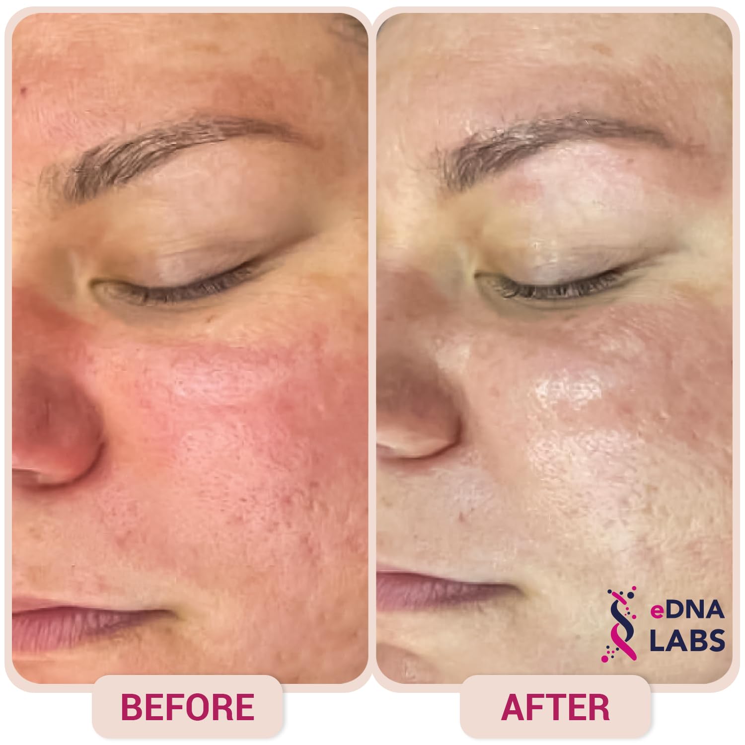 EDNA Labs Hypochlorous Acid Spray for Face & Skin | 8 oz, Facial Spray Daily Skin Solution, Made in USA