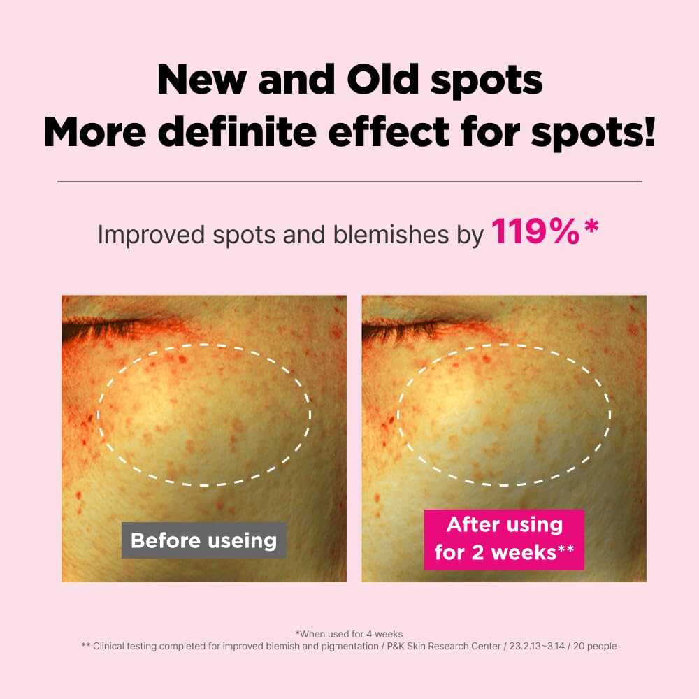 ISOI Blemish Care Up Cream 55ml (1.86 fl.oz) | Blemish Dark Spot Removal & Acne Scar Care with Bulgarian Rose Oil, 5 Layer Hyaluronic Acid | Korean Skin Care