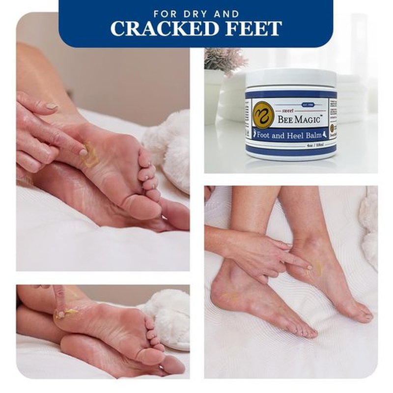 Sweet Bee Naturals Organic Foot Balm - Intensive Heel Cream for Dry, Cracked Feet - Natural Moisturizer - 4 OZ Jar