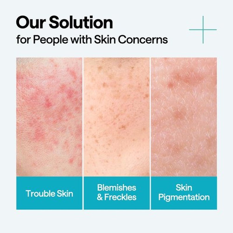 Mediheal Madecassoside Repair Serum 1.35 fl.oz - Blemish Care, Fades Pigmentation and Freckles & Skin Soothing & Hydration - with Centella Asiatica, Niacinamide