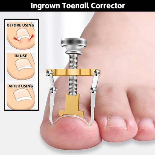 NOVANO Ingrown Toenail Removal Kit,Nail Treatment Foot Tool,Toenail Clippers for Seniors Thick Toenails,Professional Pedicure Tool,Large Toenail Clippers for Thick Nails 11Pcs