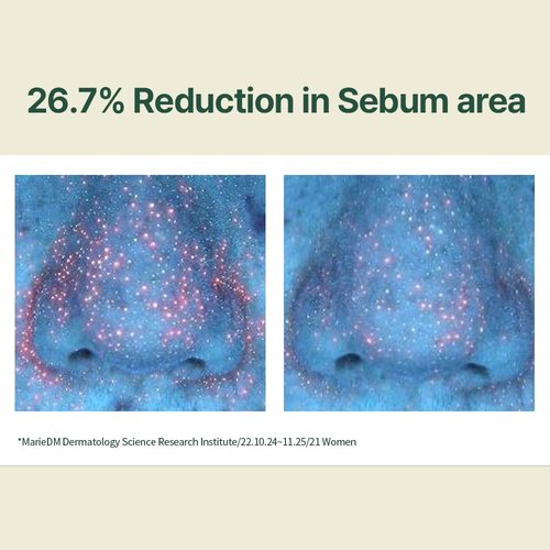 Pyunkang Yul Calming Moisture Serum - Daily Hydration & Skin Revival with Centella Asiatica, Tea Tree & 5 Hyaluronic Acids