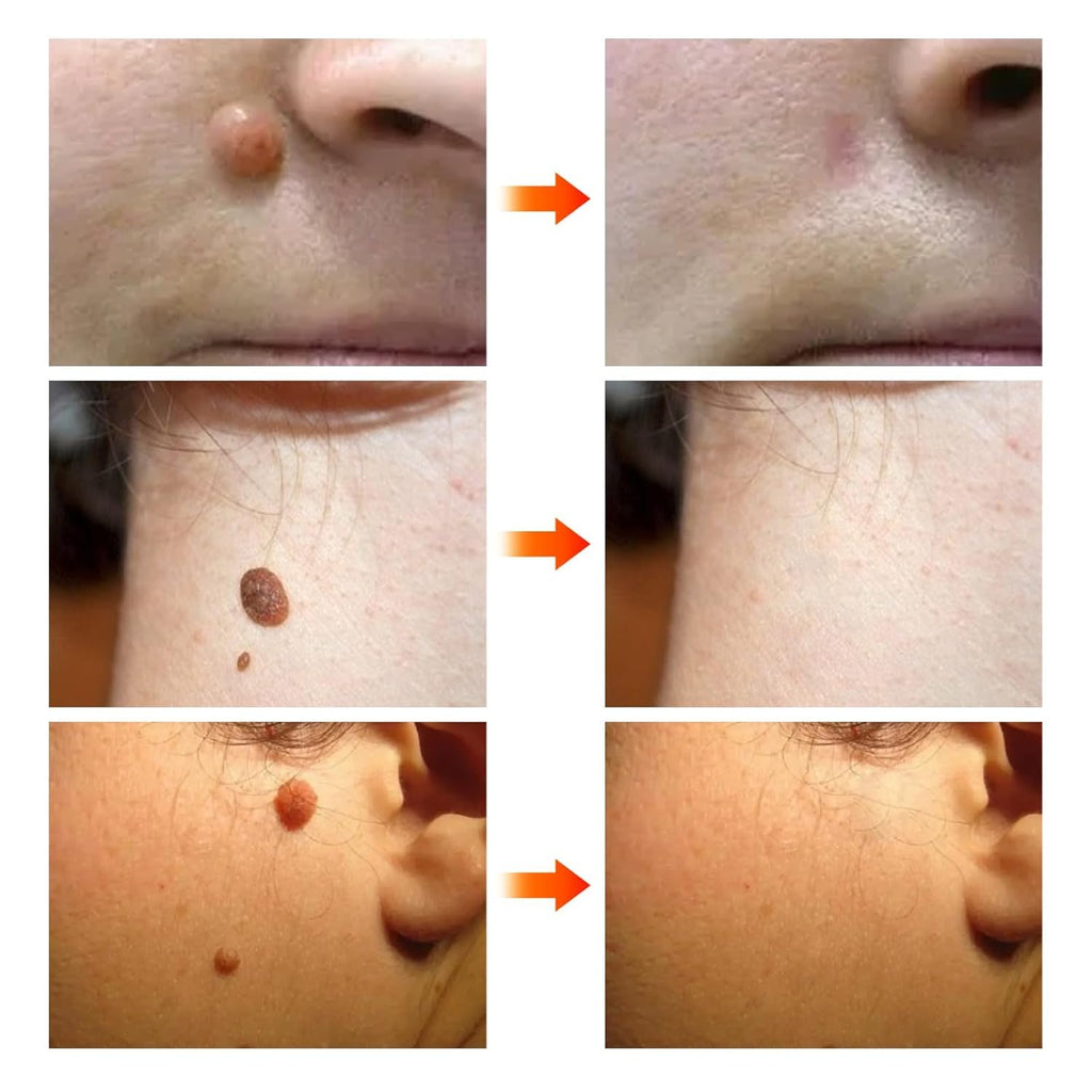 Gaukomzs 2PCS Bee Venom Cream, Visibly reduces skin blemishes and smoothes skin