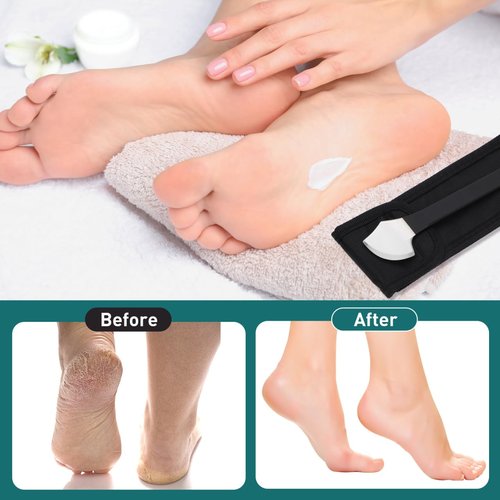 Healifty Pedicure Shaver Foot Corn and Hard Thick Skin Remover Tool Nail File Cuticle Trimmer Heel Scraper for Feet