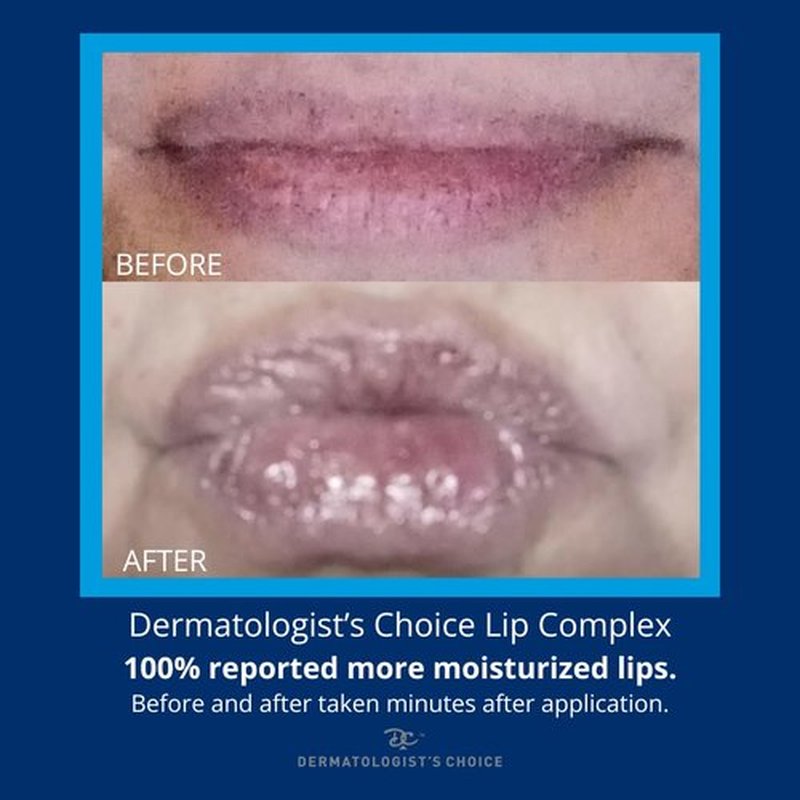Dermatologist's Choice Lip Complex All-in-One Moisturizing Ointment for Dry, Aging Lips With Castor Oil, Vitamin E, and Evening Primrose Oil to Nourish and Protect Cracked Lips
