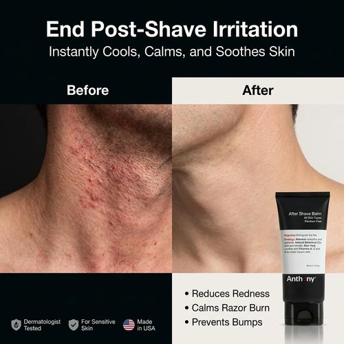 Anthony After Shave Balm - Cooling Hydrating Lotion with Aloe Vera & Vitamins A, C, E | 3 Fl Oz