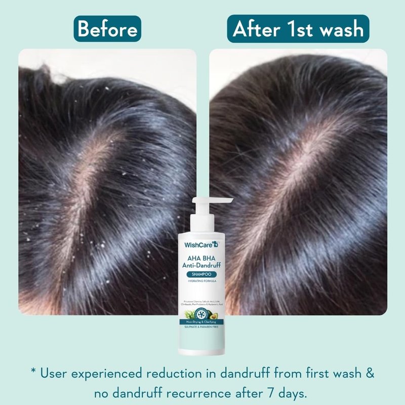 WishCare Hydrating AHA BHA Anti Dandruff Shampoo For Women & Men-Paraben & Sulphate Free Shampoo 250ml