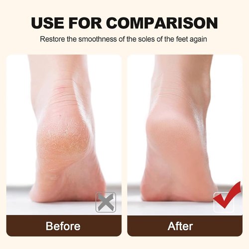 Skiennix Professional Foot Care Pedicure File - Stainless Steel Dead Skin & Callus Remover | Black