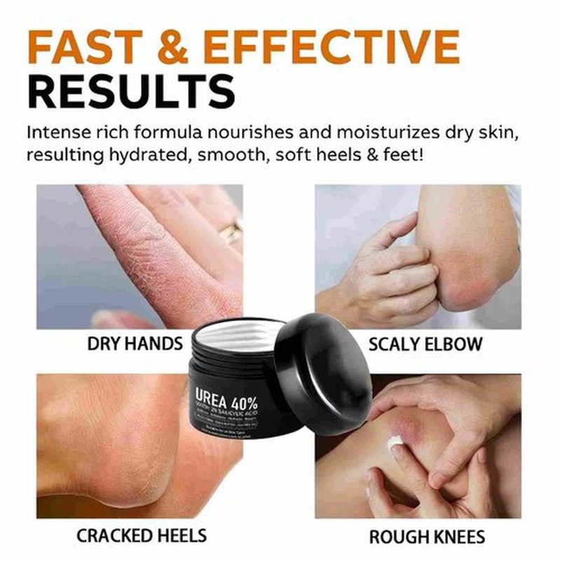 IOIOTCO Urea Cream 40% Plus 2% Salicylic Acid, Foot and Hand Moisturizing Cream for Dry Cracked Heels, Callus & Dead Skin Remover, Hydrating Exfoliating Cream with Aloe, Tea Tree, and Hyaluronic Acid