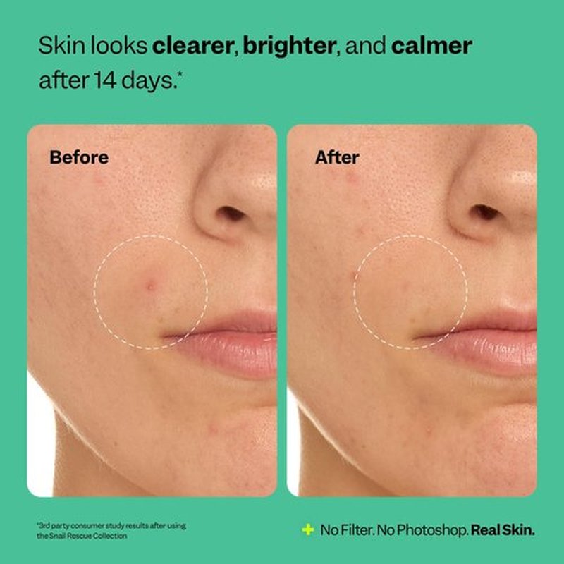 Peach Slices - Snail Rescue Purifying Cleanser (4.05 oz) - Snail Mucin Concentrate - Cleanse & Refresh Skin - Pine Bark, Hyaluronic Acid & Cica - Vegan & Cruelty Free - Korean Skin Care & Beauty
