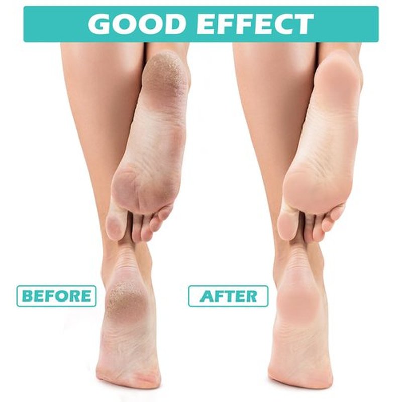 Tarpop 3 Pairs Aloe Socks Women Valentines Day Moisturizing Spa Socks for Dry Cracked Heel Feet Infused Gel Sleeping Fuzzy Lotion Gift for Women Men Softening Dry Feet(White, Green, Colorful)