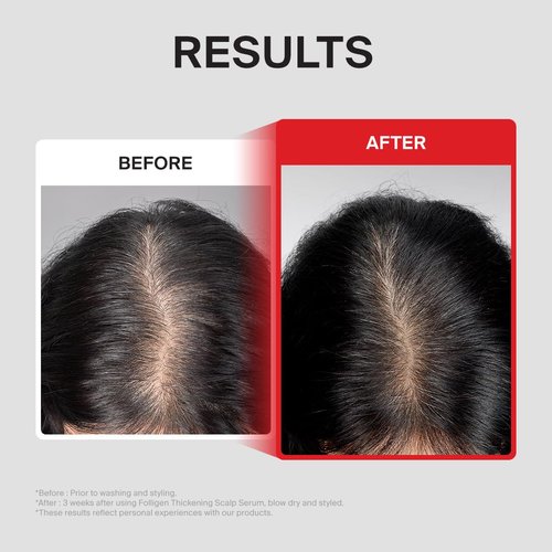 Dr.FORHAIR Folligen Thickening Scalp Serum 1.7 oz - Biotin Peptide Treatment for Thicker, Fuller Hair | Korean Haircare