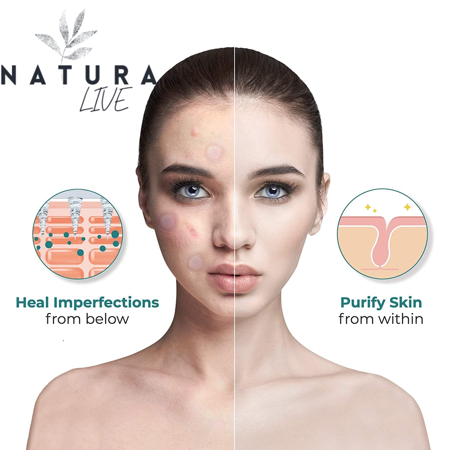 Natura Live Hydrocolloid Acne Patches – 120-Pcs Pimple Patches for Face –Blemish Patches to Cover Zits, Acne, Breakouts – Vegan and Cruelty-Free Zit Stickers – Zit Absorbing Acne Spot Dots