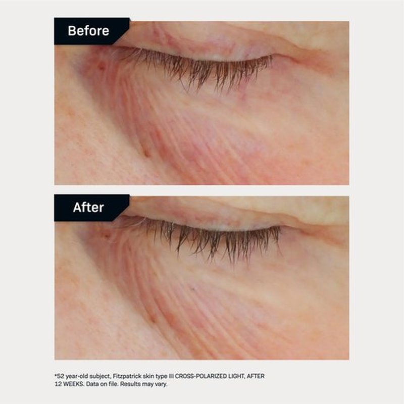 Revision Skincare C+ Brightening Eye Complex™ with Vitamin C and Antioxidants, Eye Cream for Dark Circles and Under Eye Puffiness, 0.25 oz
