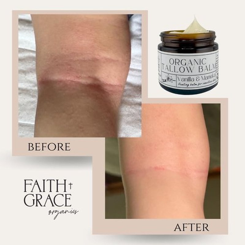 Faith and Grace Organics Beef Tallow Balm for Skin, Organic Tallow Cream with Vanilla and Manuka Honey, All-purpose Moisturizer for Face and Body- 2 oz