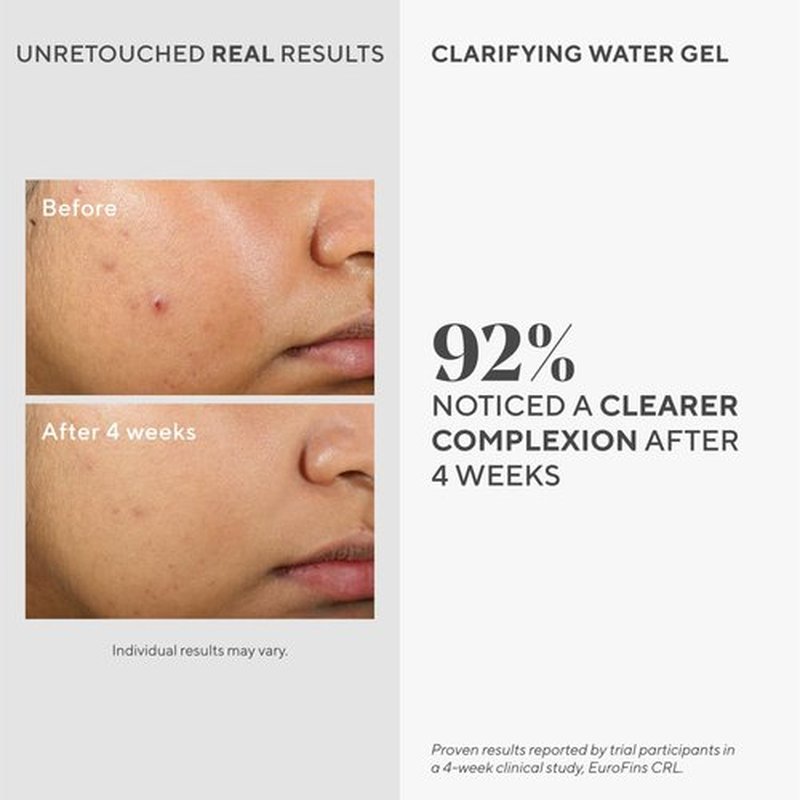 Murad Clarifying Water Gel - Lightweight Moisturizer for Acne-Prone Skin with Salicylic Acid | 2 Fl Oz