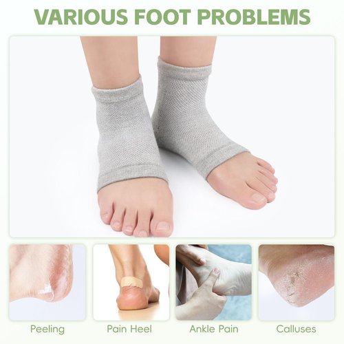 HATINXIA 2 Pairs Moisturizing Socks, Heel Socks for Cracked Heel Repair Treatment, Silicone Gel Toeless Socks, Foot Care Socks for Dry Cracked Feet Women, Lotion Moisture Pedicure Socks (Skin+Grey)