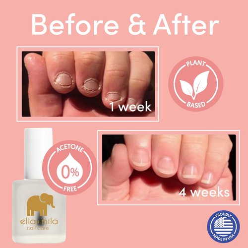 ella+mila "No More Biting" Nail Polish - Bitter Taste Nail Biting Treatment for Kids & Adults - Stop Thumb Sucking Deterrent - Finger Biter Prevention (0.45 fl oz)