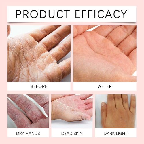 Retinol Hand Cream Anti Aging, Enriched With Collagen, It is Specially Formulated for Aging, Dry, And Chapped Hands (50G Anti Aging Hand Cream, Nourishing and Protecting Skin, Nails, And Cuticles)