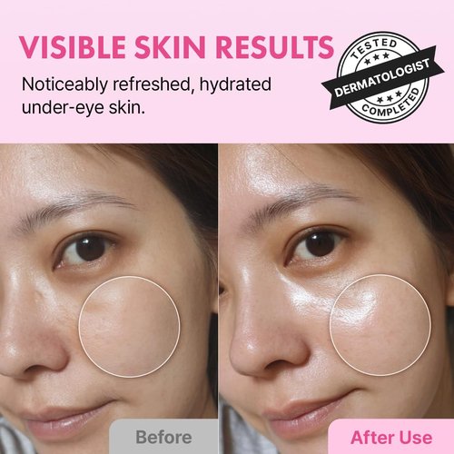Hanskin Hyaluron Eye Serum - Hydrating Eye Care with 4 Types of Hyaluronic Acid | Cooling Metal Applicator | De-Puffing & Brightening | 0.85 fl oz
