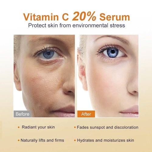 Regine Switzerland Vitamin C Serum 20% - Anti-Aging Face Serum for Radiant Skin & Fine Line Reduction