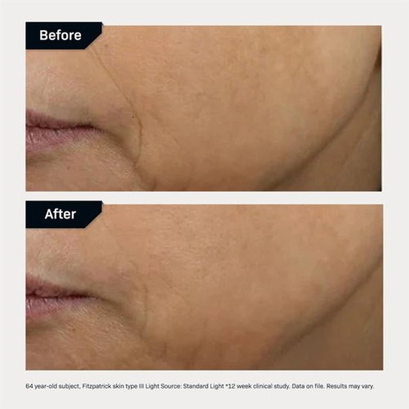 Revision Skincare D·E·J Face Cream® - Advanced Anti-Aging Moisturizer for Lifting & Firming, Antioxidant-Rich