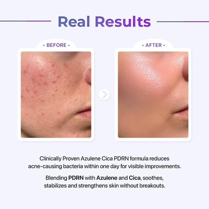 Le Nubele Azulene Cica PDRN Fiber Light Serum 01, Salmon DNA PDRN 2,000ppm, Peptide, Panthenol, Skin Restoration, Barrier-Repair, Hydrating & Firming, Korean Skin Care, 30ml/1.01 fl.oz.