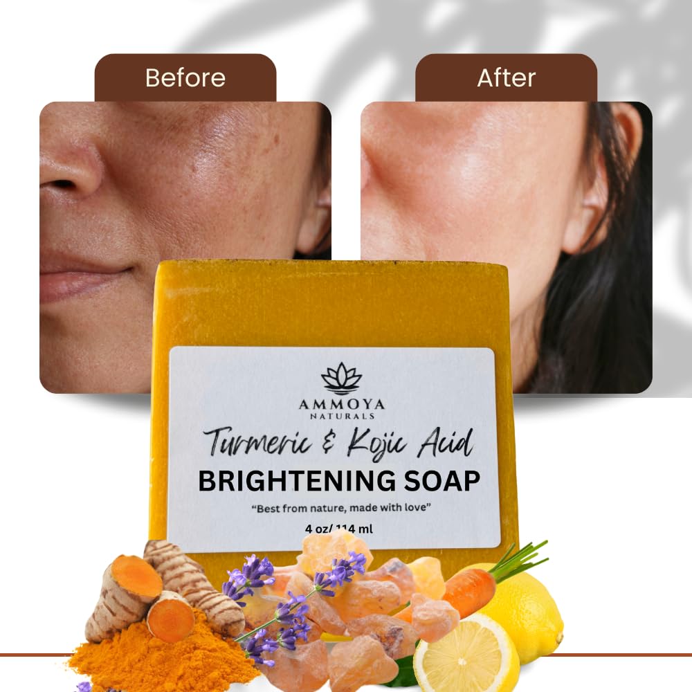 Ammoya Naturals Turmeric Skin Cleansing Soap - Natural Glow Face & Body Cleanser for Acne, Dark Spots & Scars, Gentle for All Skin Types - 2 Bars (4.5 oz)