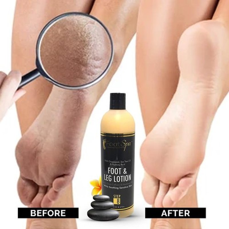 Foot SPA - Healing Therapy Massage Lotion, 16 Oz - with Peppermint and Eucalyptus - Professional Pedicure, Body and Hot Oil Manicure, Infused with Natural Oils and Vitamins