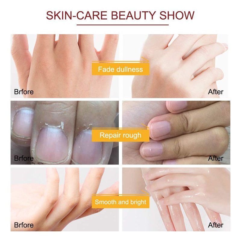 ZIXAOK 5 Pairs Hand Mask Gloves, Moisturizing & Repairing Treatment for Extra Dry & Rough Skin, Exfoliating Peeling Mask for Home Spa Care, Men & Women