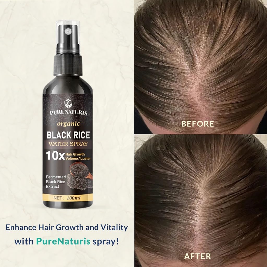 PureNaturis Castor oil Ginger Rice Water for Hair Growth Serum - Leave-In Spray for Men & Women, Effective for Hair Loss, Dry Damaged Hair, Hair Regrowth for Thicker, Fuller, Longer Hair, 3.5 fl oz