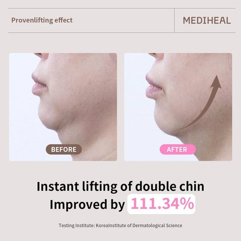Mediheal Retinol Collagen Ampoule Lifting Mask (10 Counts) forV Line Mask, Anti-Aging - Helps Reduce Fine Lines & Wrinkles, and Smoothens Skin