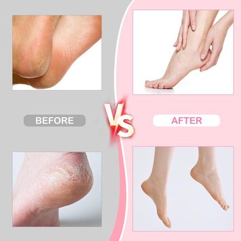 Electric Foot Callus Remover,Powerful Electric Foot File, Professional Adjustable Speed Pedicure Tool with 60 Pcs Replacement Sandpaper Discs for Dead Skin and Calluses-Pink