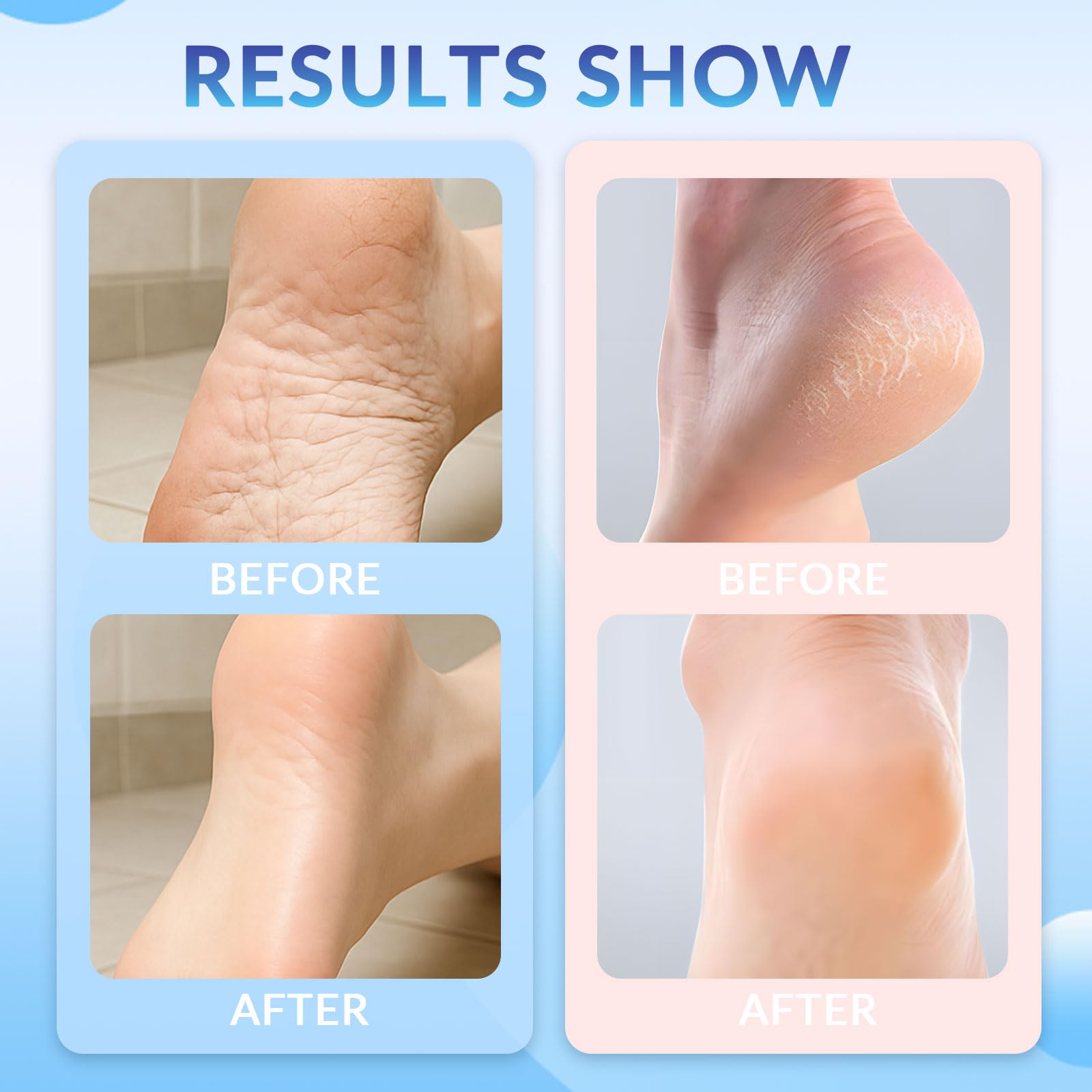 XICOFISS Crack Feet Prevention Stick, Anti Cracked Foot Cream For Dry Heels, Moisturizing Foot Balm Stick, Remove Dead Skin And Softening Dry Skin (Pink+Blue)