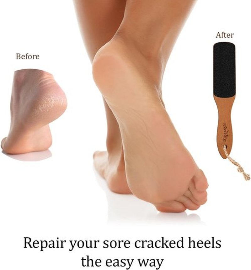 Skiennix Foot File - Double-Sided Pumice Stone for Callus Removal & Smooth Feet | Ideal for Dry Skin